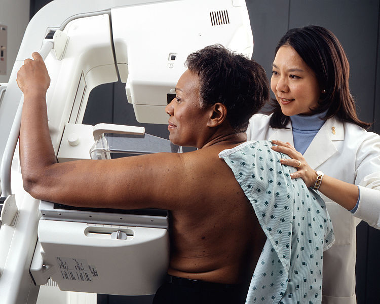Leveraging Behavioral Reinforcement Learning to Promote Mammograms